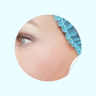 Migliora l’aspetto delle rughe